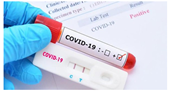 Các cơ sở y tế tư nhân không được tăng giá xét nghiệm COVID-19